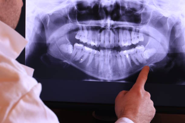 Best Emergency Dental Services for Seniors in Holdenville, OK